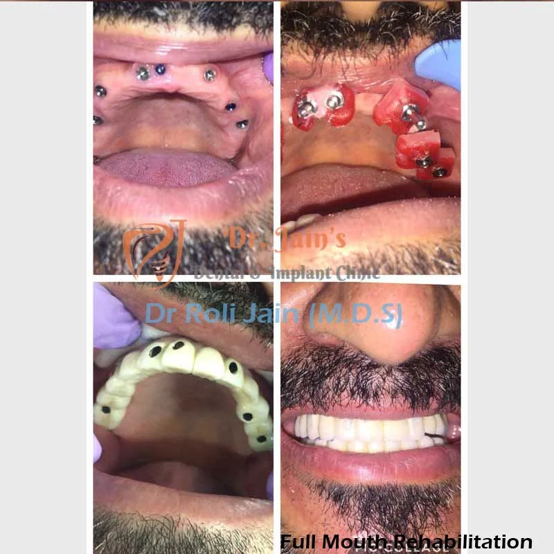 Dr Jain Dental & Implant Clinic