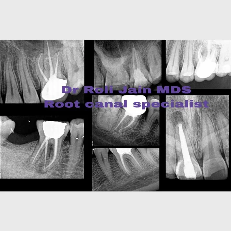 Dr Jain Dental & Implant Clinic