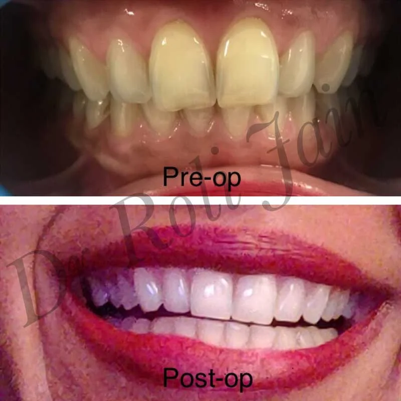 Dr Jain Dental & Implant Clinic
