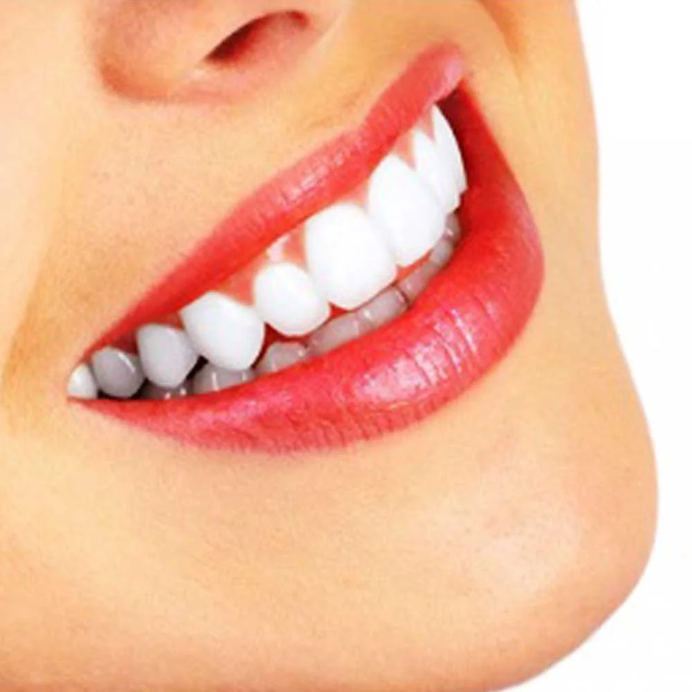 Teeth Whitening